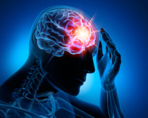 How Apex Law Firm, PLLC Can Help You After a Brain Injury In Tampa, FL